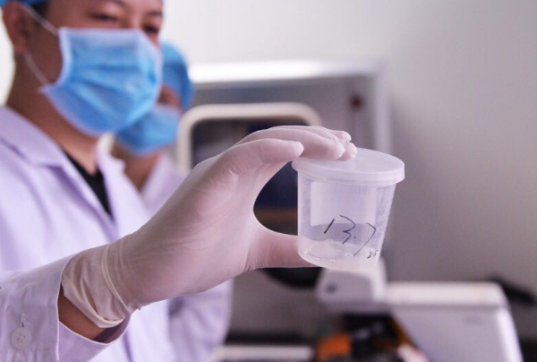 抗精子抗体能自愈吗