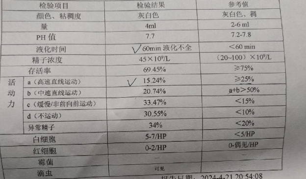 精液不液化怎么治疗
