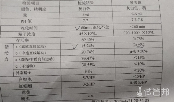 8b5a08ee35d6baf113999c7d61102402.png 精液不液化怎么治疗