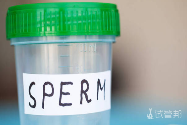 715fb471ef1420aa6a1d638e9ed7ca40.png 精子质量低会导致不育吗