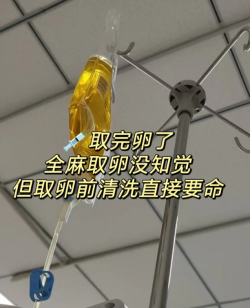 全麻取卵没什么感觉，但清洗真要命