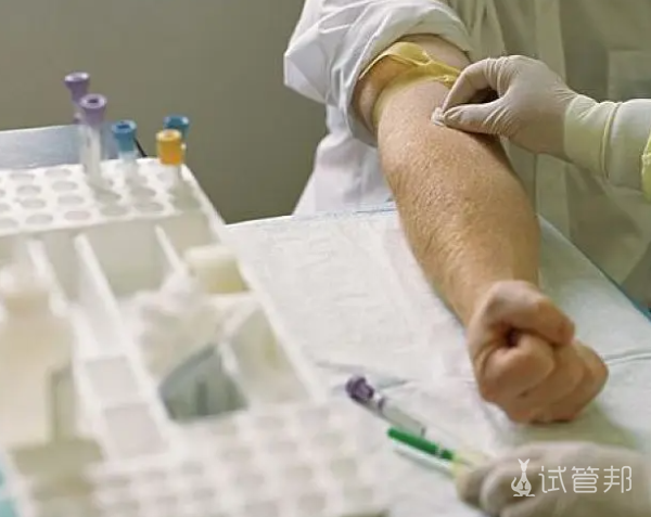 da8f409f6096724e24a32f3edbddb995.png 一般优生四项检查结果多长时间出来