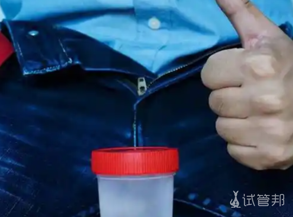 59d103fa97ffed37cdf8d764930d8842.png 精液ph值代表什么意思