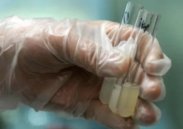 fa9cf38f7aa7f3761b1b58074277d2bc.png 精液的PH值8.2正常吗