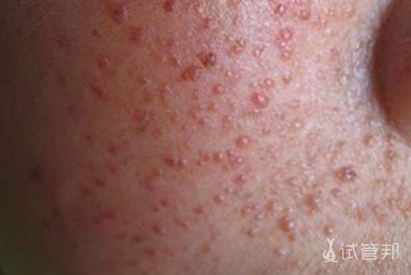 58e3daf53884a356695628cf72f1cd9e.png 女性梅毒最先长在哪里