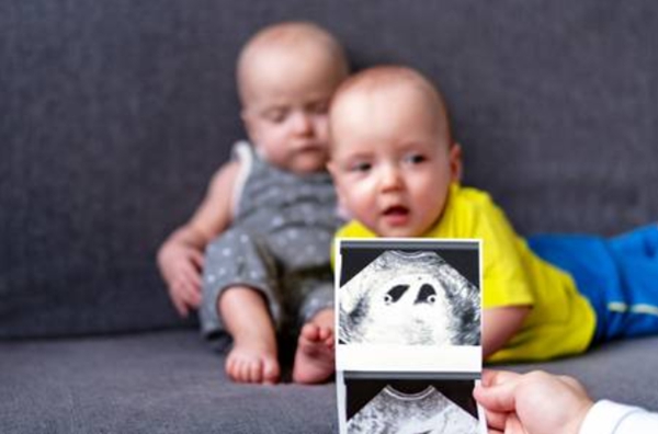 22a1b725dc9c8e9739afd3fd848223f1.jpg 同卵双胞胎为什么会分裂