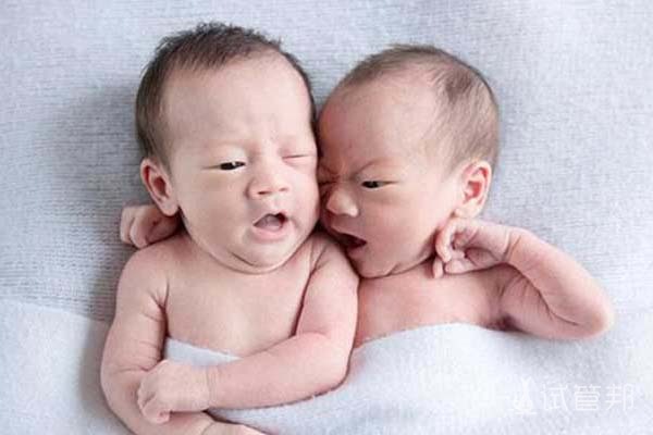 693d186aa858093680a7f78f9aaf0851.jpg 连体双胞胎一个死了另一个还能活吗