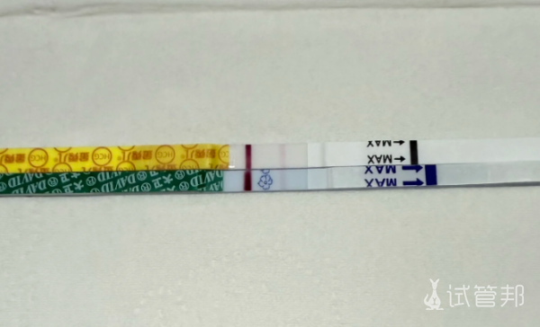 b5370c63adc33315df705c2d9d1a756a.png 试管移植后必看我的14天黄金保胎指南