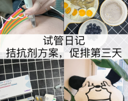 促排Day3果纳芬真的不疼！但胀感是真的…