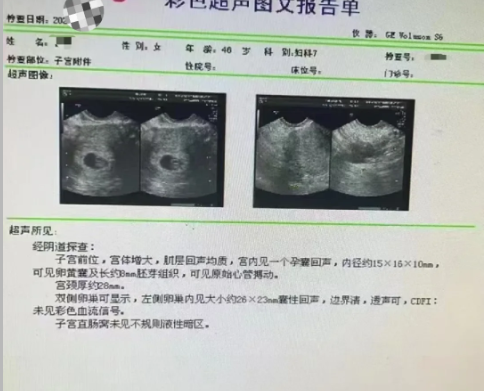 46岁喜提4AA小王子