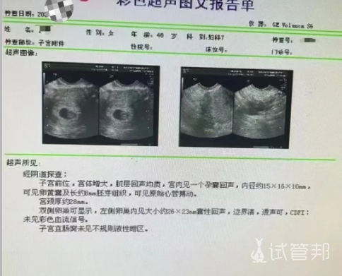 509bae81f7bc724a747d4399b5d96901.png 46岁喜提4AA小王子