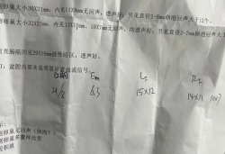 尿促后卵泡冲到15mm！这个速度算快吗？