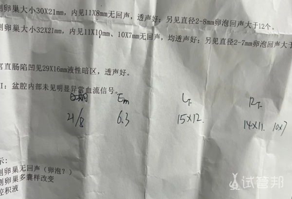 02606ebde22c83286c028d5803d9f09e.png 尿促后卵泡冲到15mm