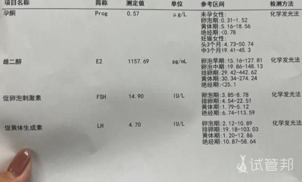 54d1df2f2a3c05e38b27c1c19ae8a055.png 试管促排4天卵泡涨到12个