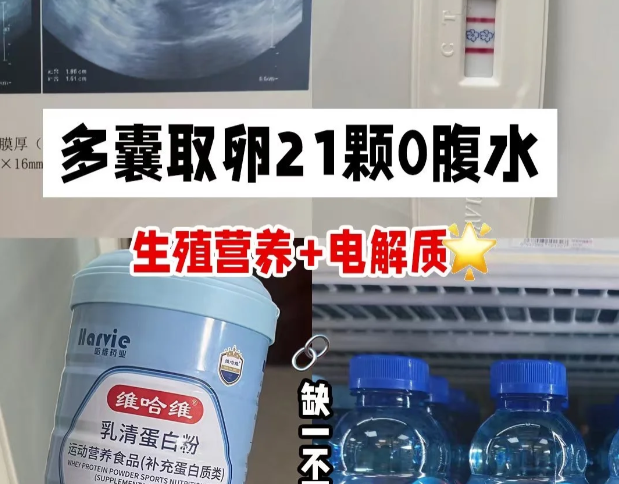 多囊取卵21颗0腹水
