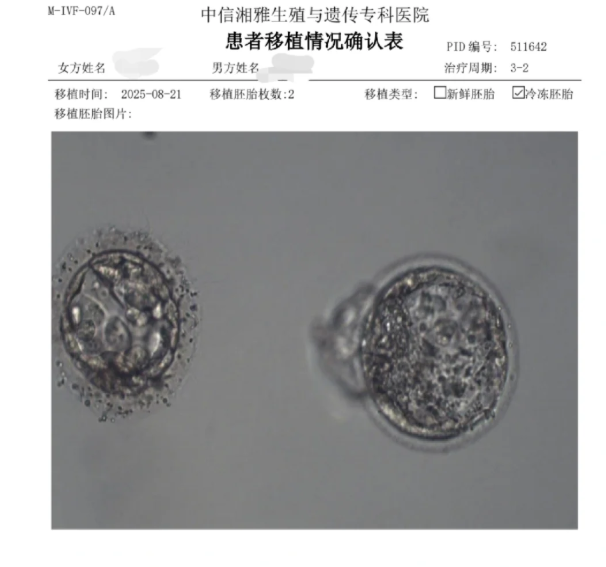 接上我的4bc小宝啦
