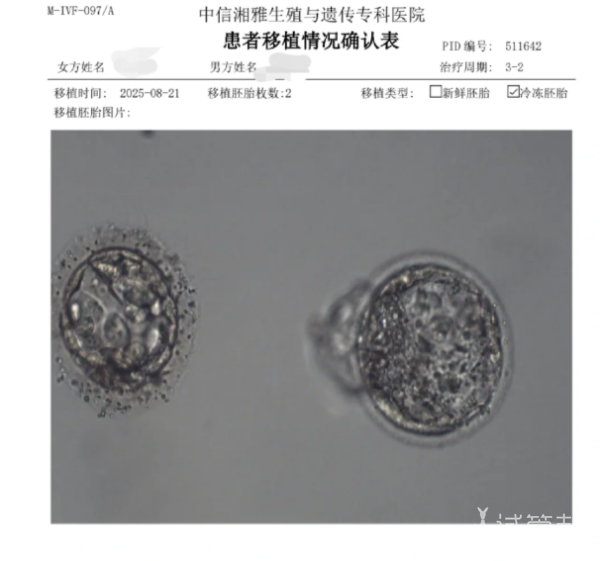 adae09f62e674cb8237392f8b4f634b6.png 接上我的4bc小宝啦