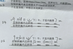 多囊促排全记录，两年弯路后终于找对方法！