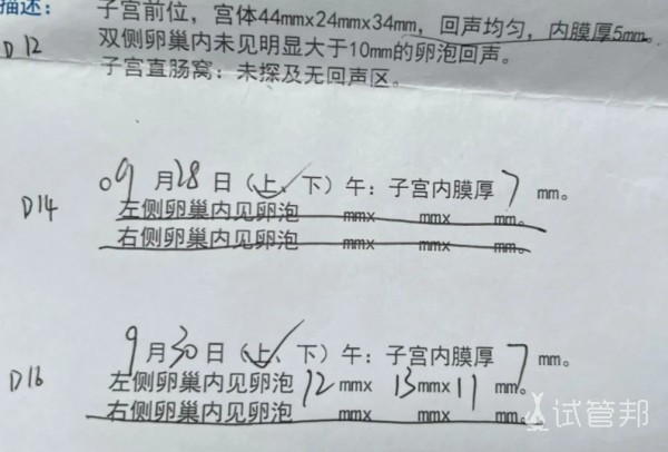 53dfd70ebfd4f95b0b6d2a2fb5df9b54.png 多囊促排全记录两年弯路后终于找对方法