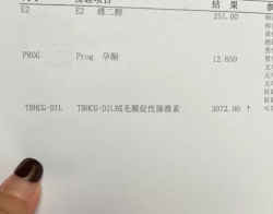 冻胚移植成功！等待过程好煎熬