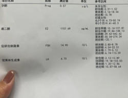 试管促排Day4！卵泡12个+省钱攻略+日常想揍队友！