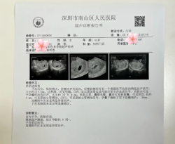 40岁双侧输卵管堵塞，试管失败4次后竟自然怀上二胎！玄学赢了！