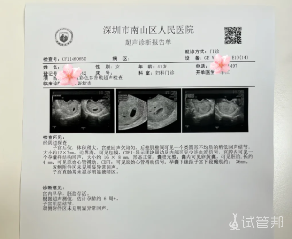 7d2b4a3c2b2724b2fb239936de6c89ad.png 40岁双侧输卵管堵塞试管失败4次后竟自然怀上二胎