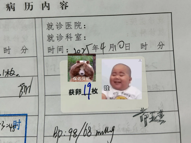 黄体酮方案取卵19个