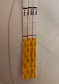 试管移植第六天测到双杠！附详细着床症状分享