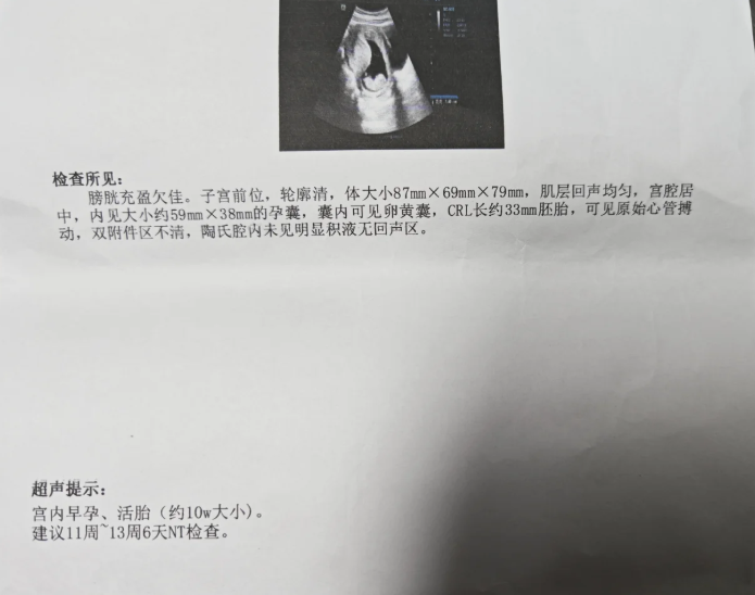 孕10周突然出血块