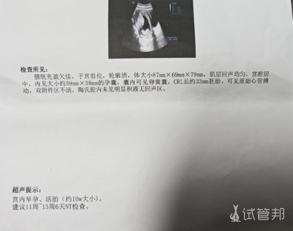 3ac99b9f03f245b33aab87fabac8d568.png 孕10周突然出血块