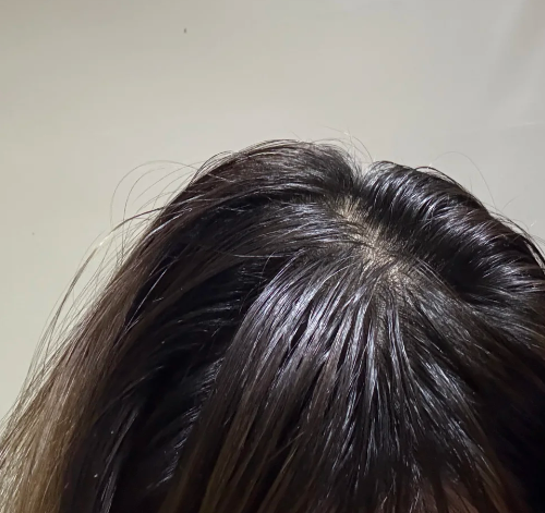 移植第五天我变成大庆油田