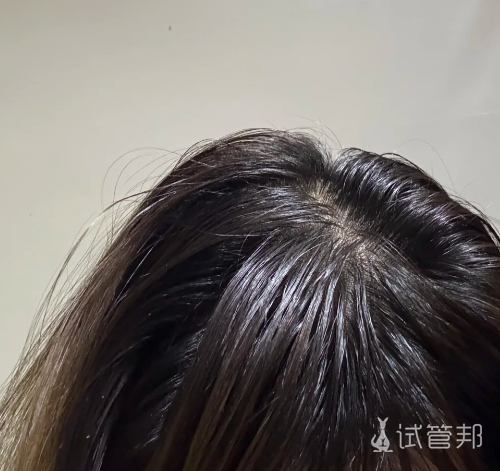 af2916f091dab6d3363afe1458a21b6b.png 移植第五天我变成大庆油田