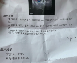 拿到B超单别慌！如果看到“内膜三线征”，你可以先偷偷开心一下！